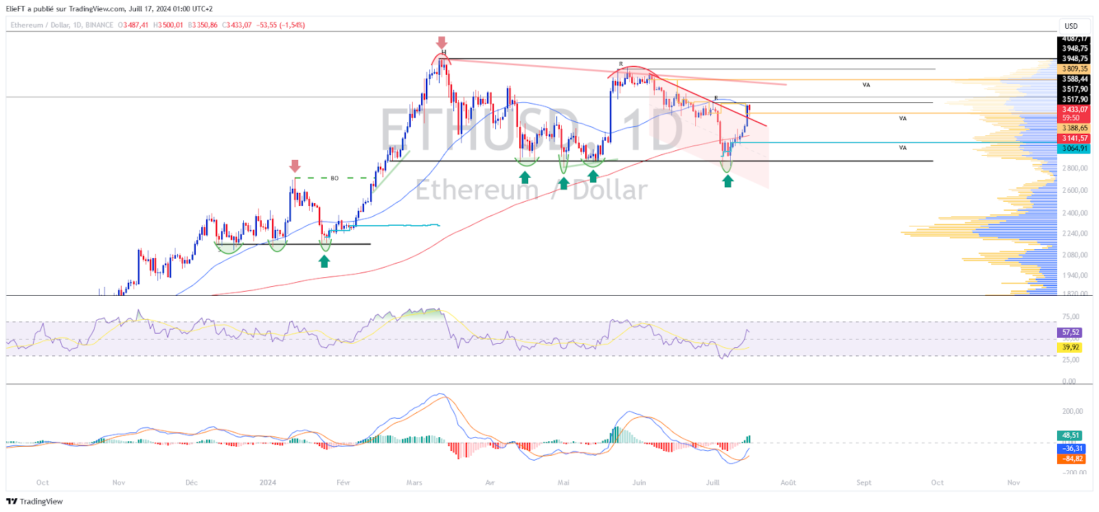 ETH/USD Chart (1D)