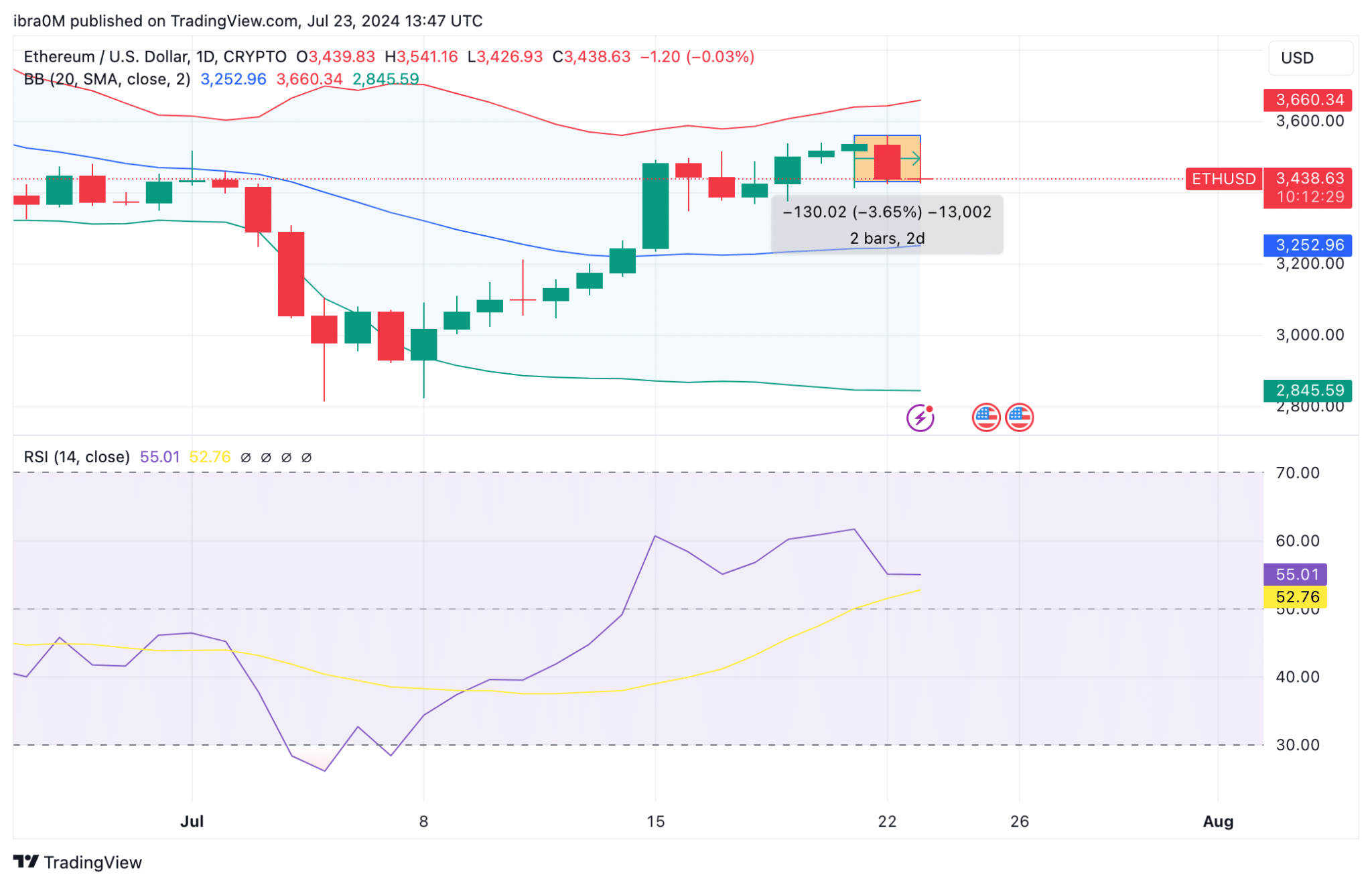 Ethereum Price Prediction | ETH/USD